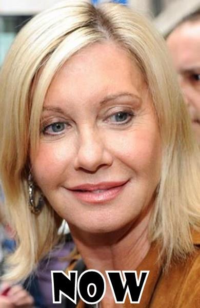 Olivia Newton-John