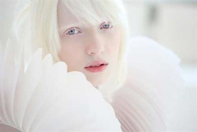 Beautiful albinos model