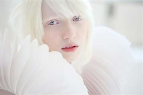 Beautiful albinos model