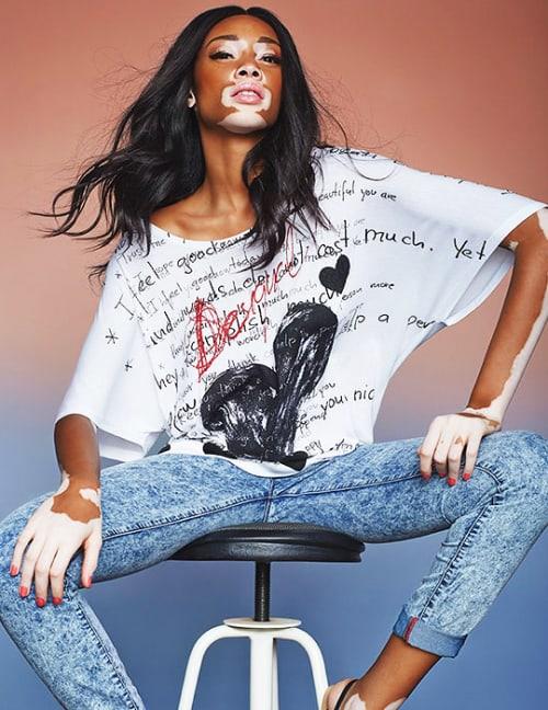 Winnie Harlow
