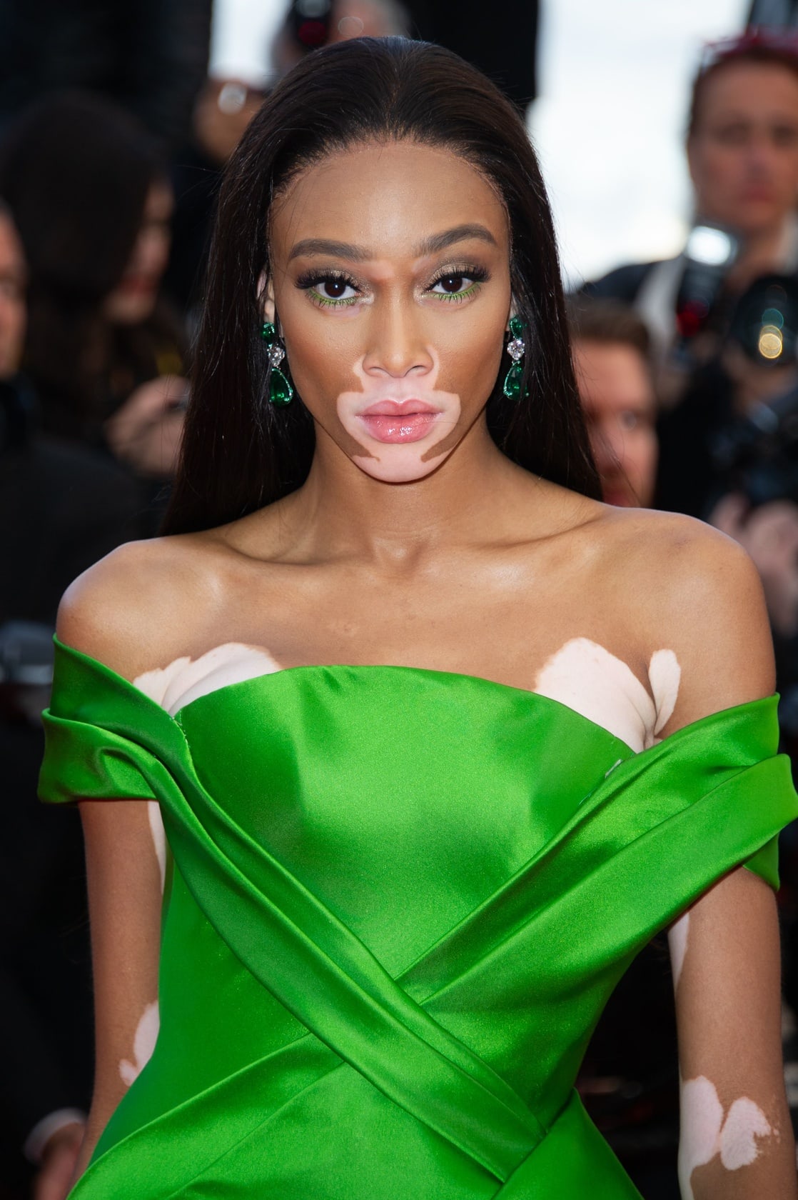 Winnie Harlow