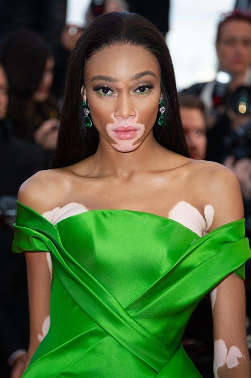 Winnie Harlow