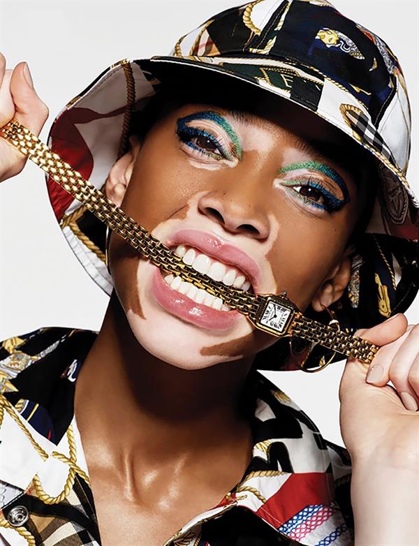 Winnie Harlow