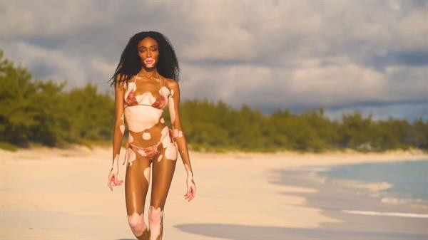 Winnie Harlow in a bikini