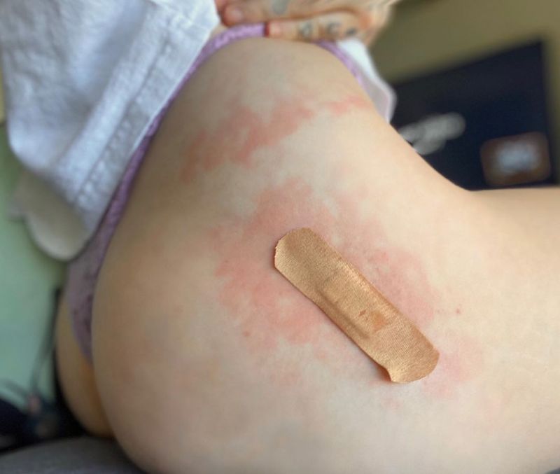 Noah Cyrus was bit by a spider and she posted a couple photos of it at the same time showing off her sexy ass in thong panties close up.