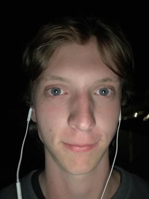 Wet Boy Pictures he is OVER 1 years old and Very unnattractive 8